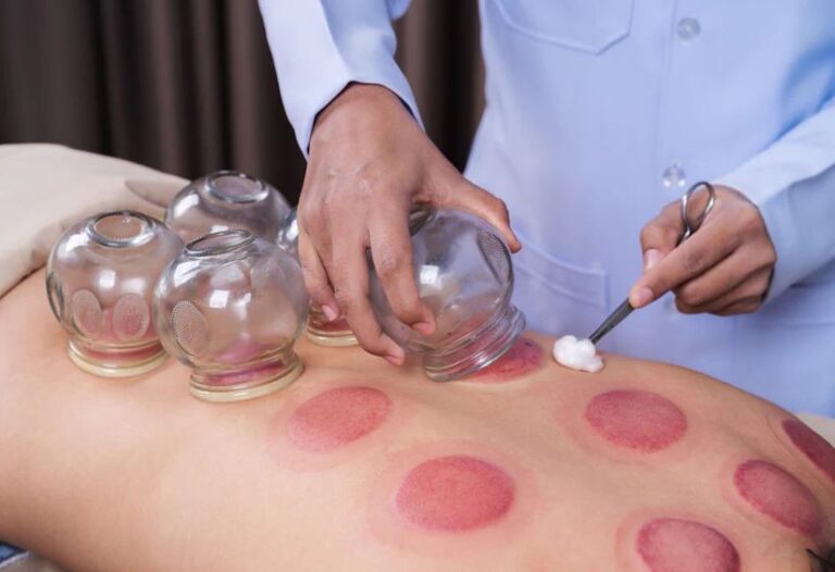 Best Oils Cupping Aftercare