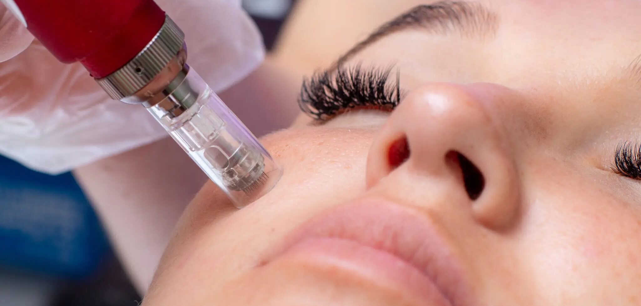 microneedling brooklyn ny