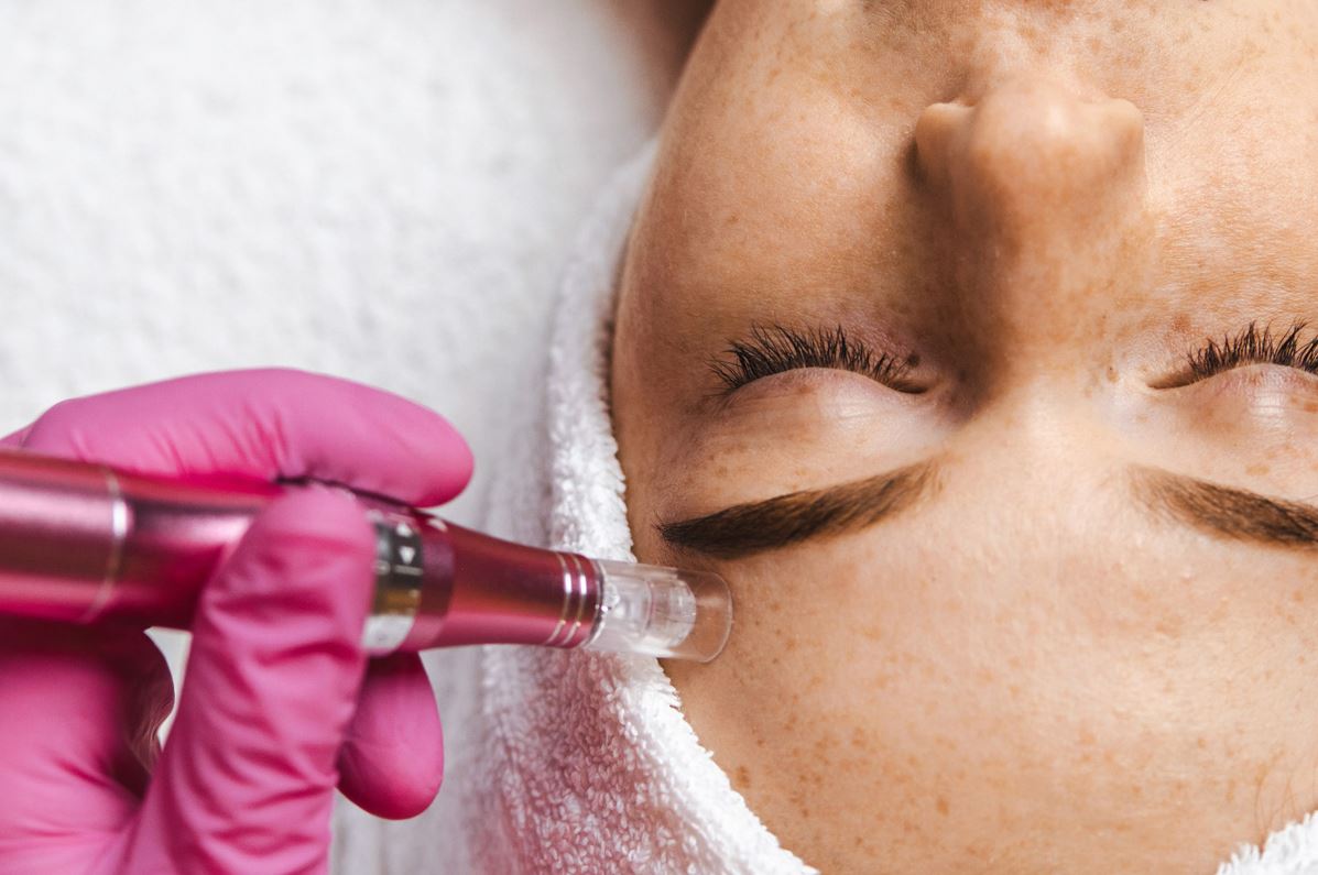 basic microneedling brooklyn ny