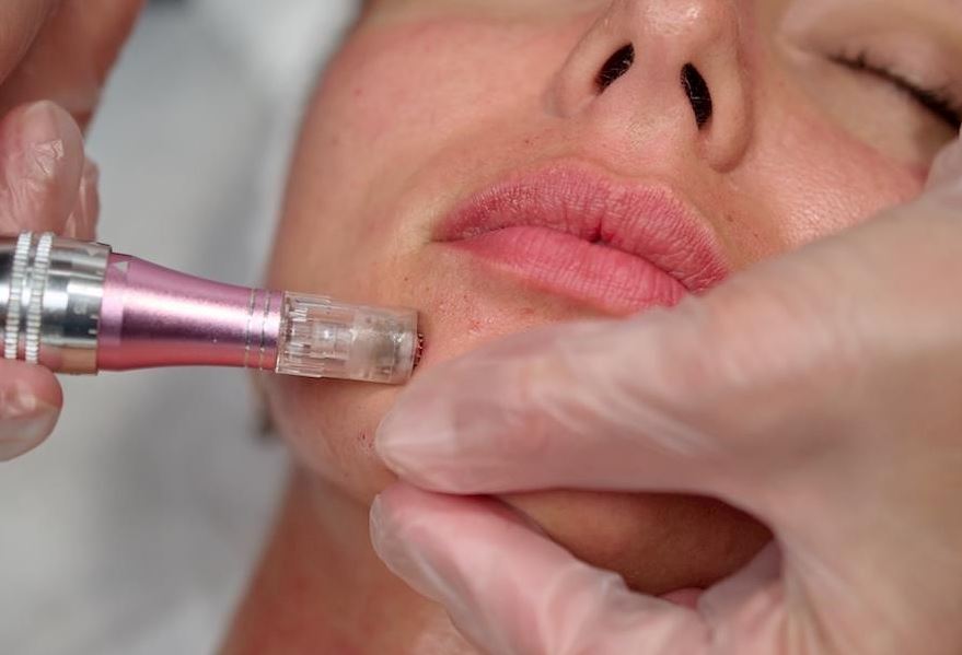 hydrating microneedling brooklyn ny