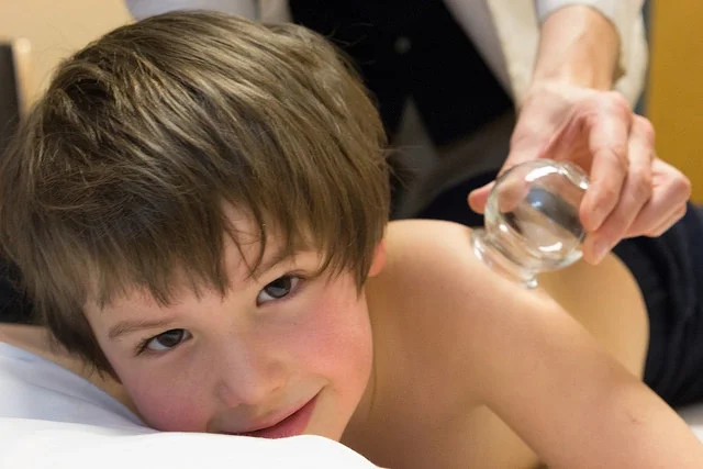 cupping for children