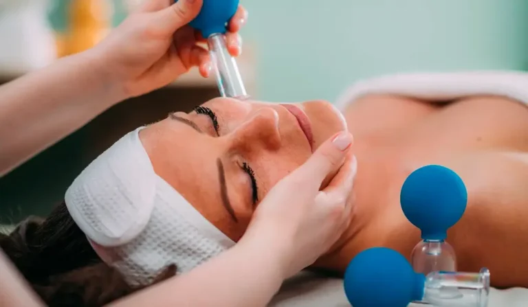 hijama facial cupping